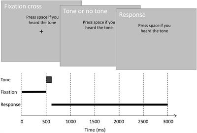 Effects of a Manual Response Requirement on Early and Late Correlates of Auditory Awareness